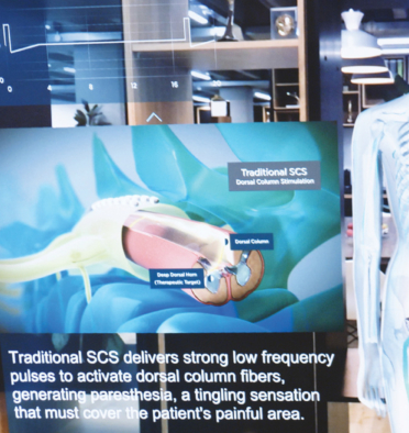 Augmented Reality skeleton designed by Random42