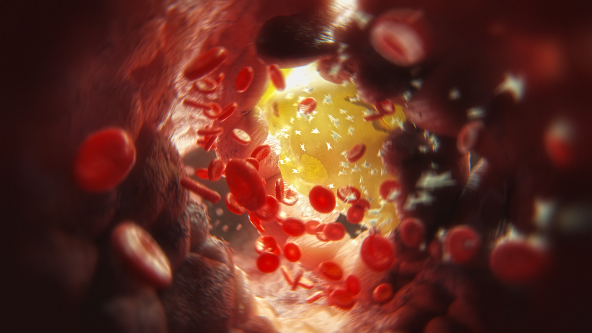 3D model of a blood vessel designed by Random42