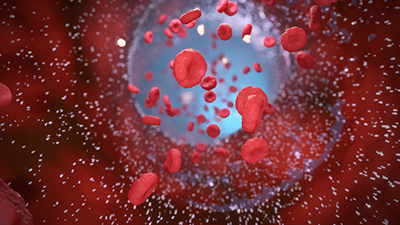 3D model of Drug Coated Balloon designed by Random42