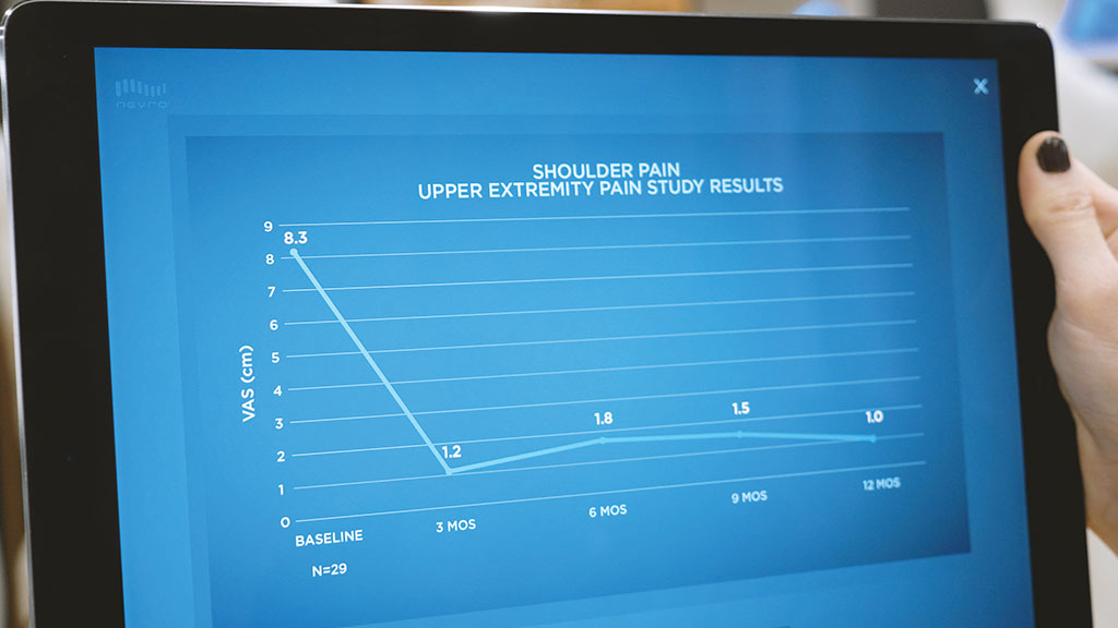 Line chart designed by Random42