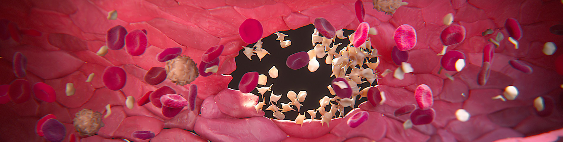 Hematology-Blood-Vessel Hematology Blood Vessel