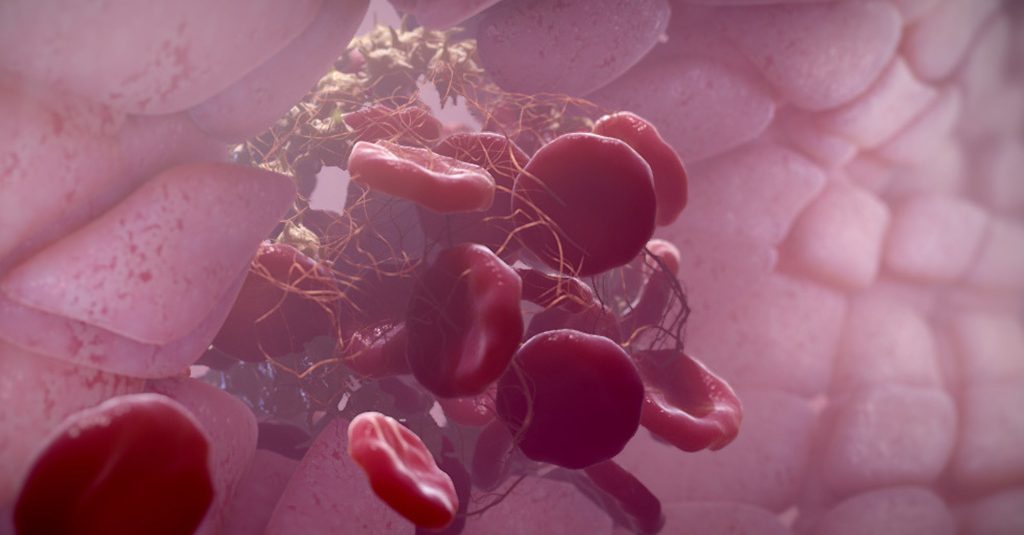 Hematology-conference Hematology conference