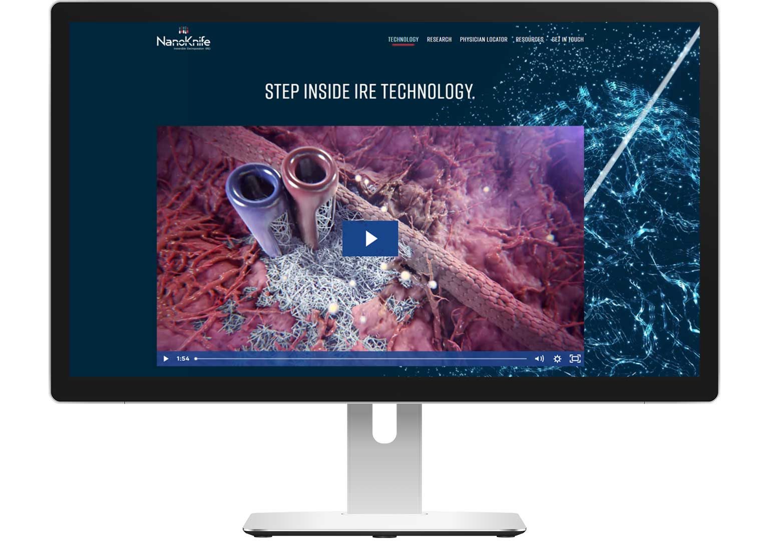 Irreversible-Electroporation-Medical-Animation Irreversible Electroporation Medical Animation
