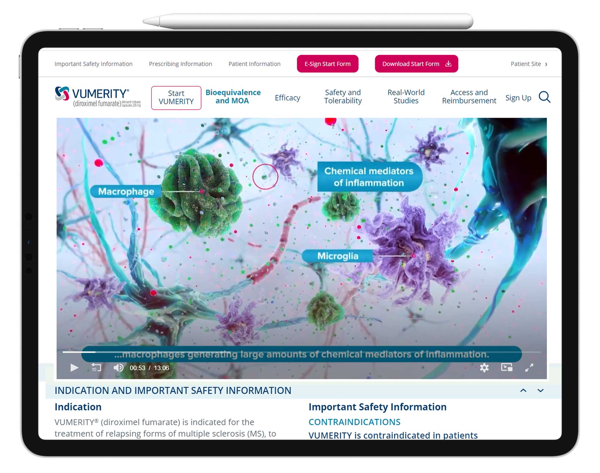 Multiple_Sclerosis_Product_Animation Multiple Sclerosis Product Animation