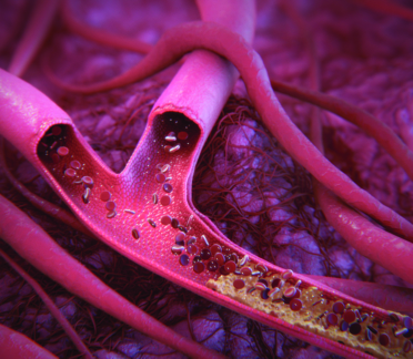 3D model of a blood vessel normal stent designed by Random42