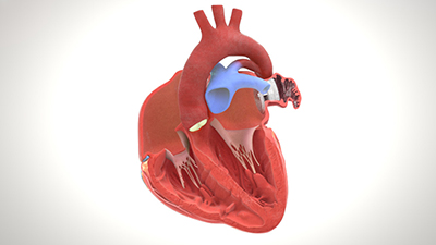 Random42 Interactive Cardiovascular Portfolio