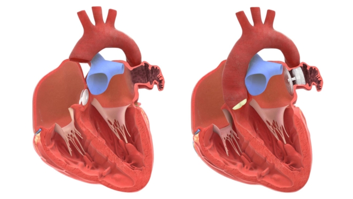 3D model of human heart designed by Random42