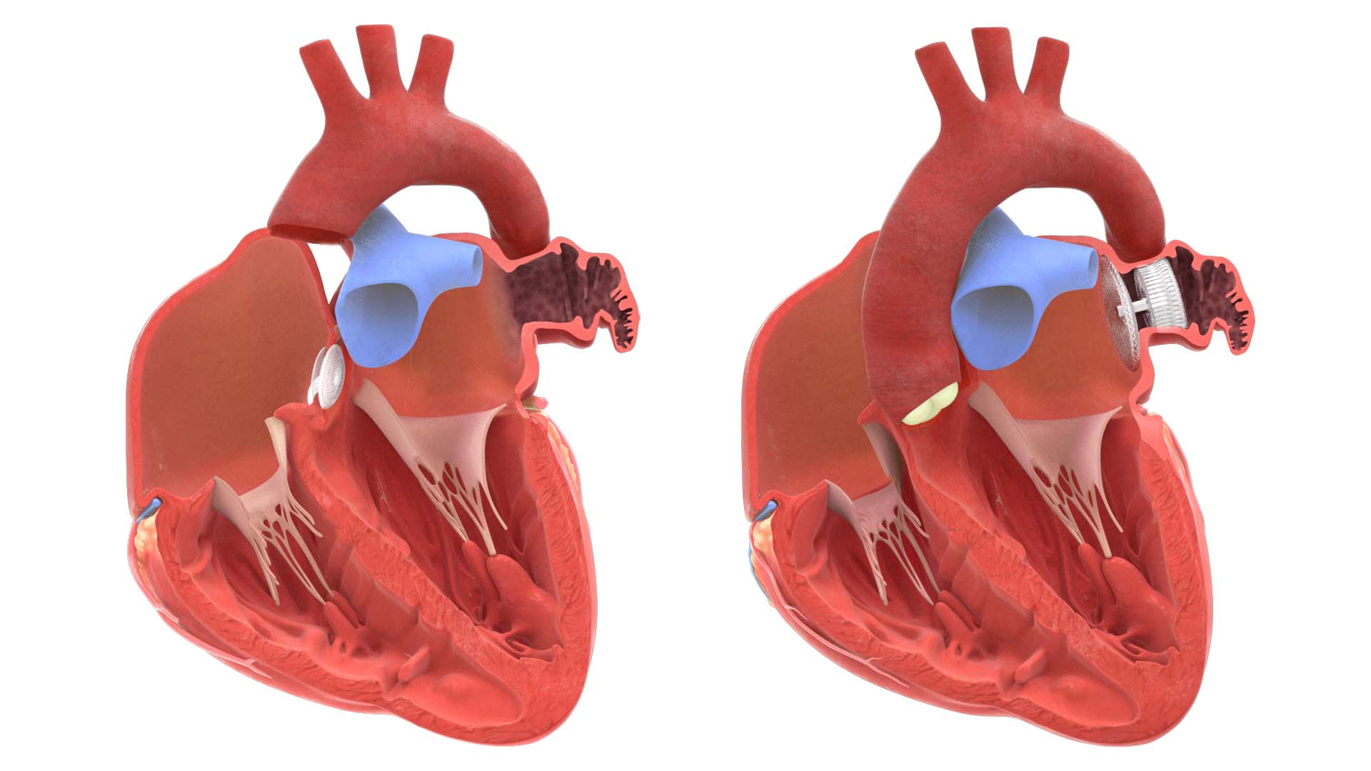 Interactive-Heart-Products-Portfolio Interactive Heart Products Portfolio