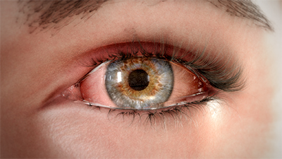 Dry Eye Disease Virtual Reality
