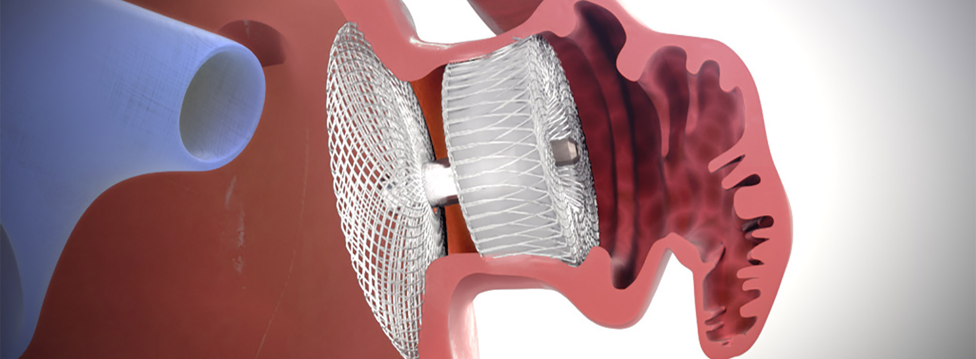 3D model of amulet appendage designed by Random42