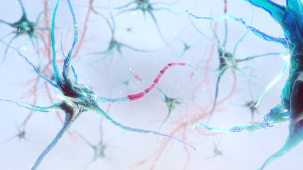 Multiple Sclerosis Medical Animation