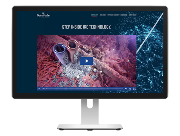 Electroporation Medical Device Animation