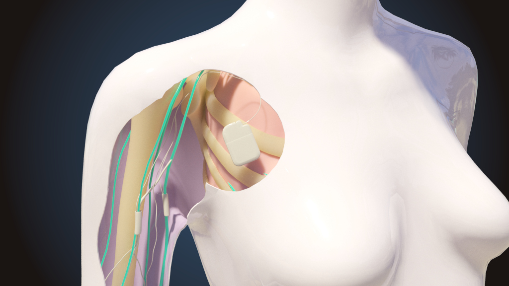 Neurotech Medical VR