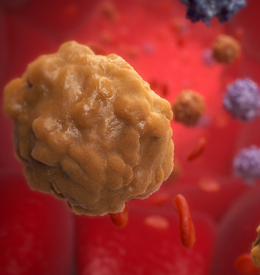 Hematologic Malignancies Interactive Game