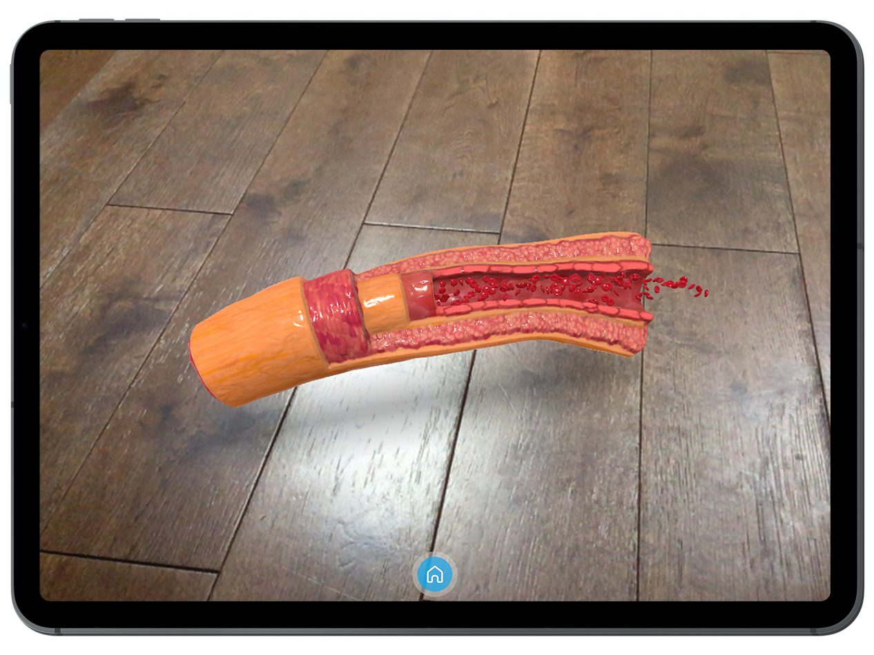 Augmented reality for ASH 2023