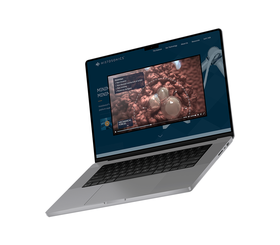 Histotripsy platform animation